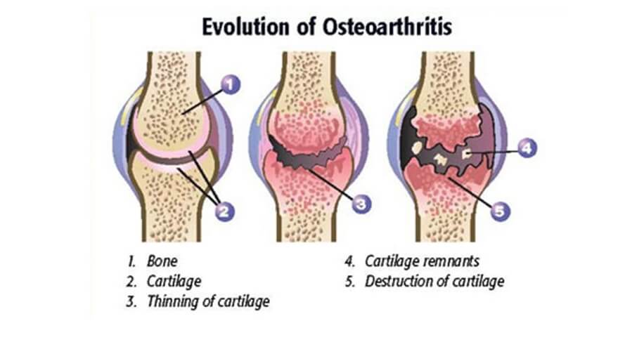 canine arthritis