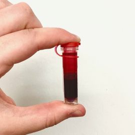 Only a small amount of blood is necessary for the pre-anaesthetic blood test. Approximately half a millilitre!